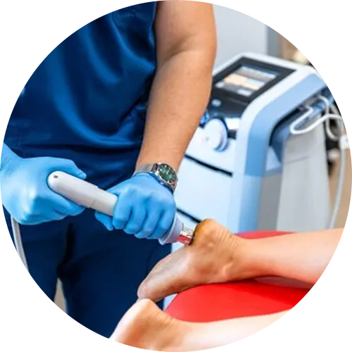 Shock Wave Therapy
